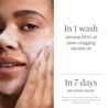Woman applying Evenly Clear™ Acne Cleanser. In 1 wash remove 85% of pore-clogging excess oil. In 7 days see visible results