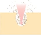 microclear2-fi-fi-Neutrogena