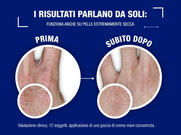 Neutrogena® Norwegian Formula® Crema Mani Concentrata Non Profumata - Image 2 - Neutrogena - it-IT
