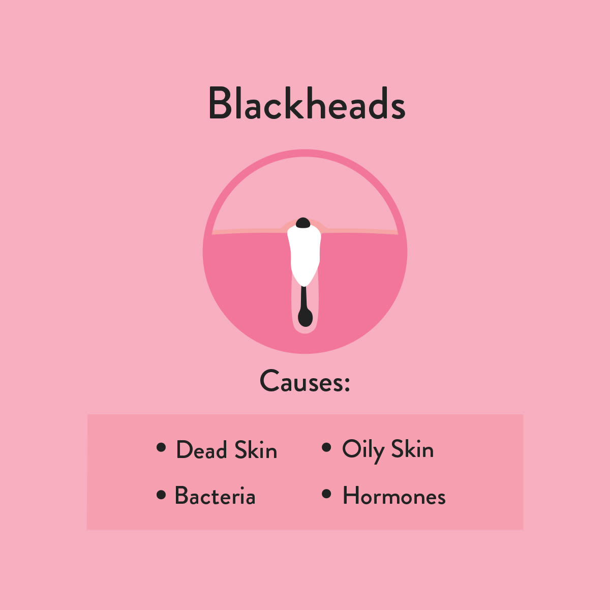 Blackheads