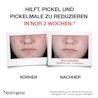 Hilft, Pickel und Pickelmale zu reduzieren in nur zwei Wochen. Klinische Bewertung, 67 Teilnehmer, Anwendung einmal täglich in der ersten  Woche, danach zwei Mal täglich