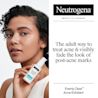 NA-US-NTG-Acne-Exfoliant-KV-ATF2-Amazon-3000x3000.webp