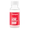 NTG_070501103227_US_Stubborn_Acne_Spot_Drying_Lotion_1OZ_OOB1.webp