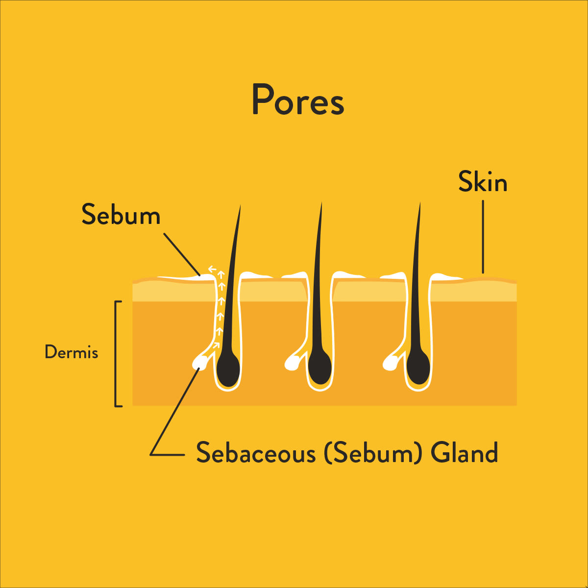Pores