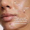 NA-US-NTG-Acne-GelMoisturizer-InsightsAcne-ATF3-Amazon-3000x3000.webp