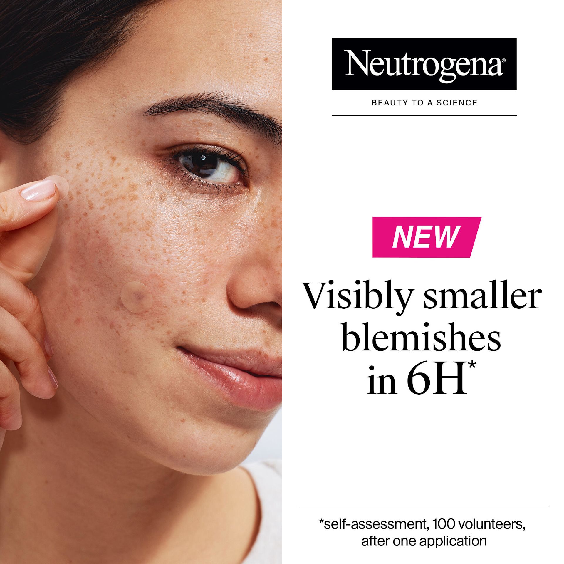 NTG EMEA UK 3574661889047 91005800 EMEA Neutrogena Sensitive Blemish Patch 30pc SI01 THUMB JPG