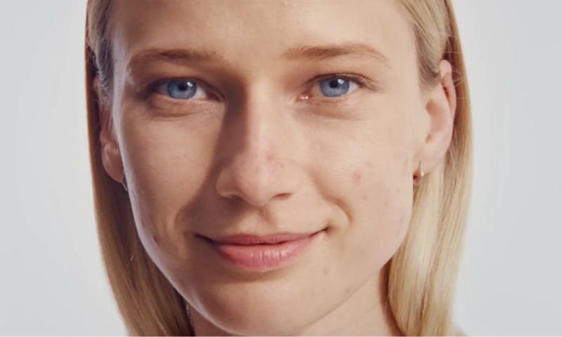 Woman with acne free clear skin after applying Neutrogena® Acne Regimen Duo