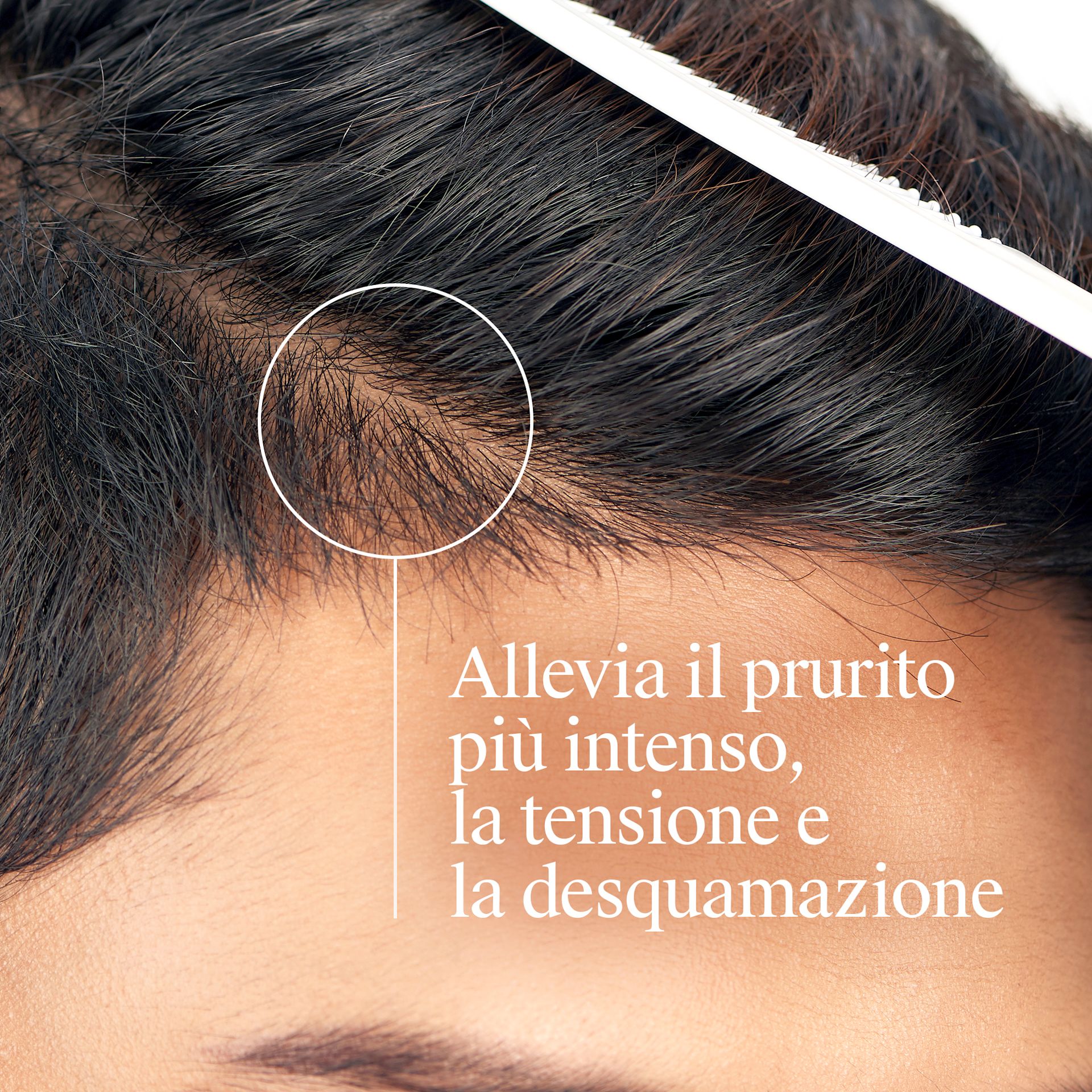 3574660008579 NG TGEL NPI ITCHY SCALP B+ DEF SI 03