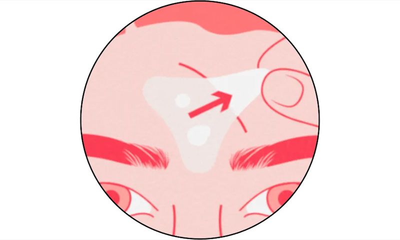 Peel off when patch turns white or 6-8 hours after application.