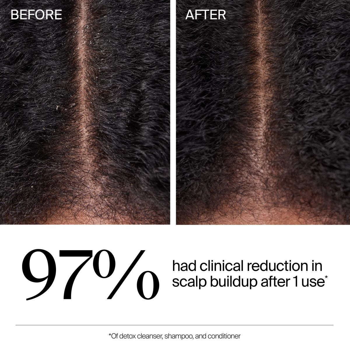 122402_KEN_NTG_Hair_Triple_Action_Scalp_Detox_Cleanser_ATF_06.webp