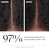 122402_KEN_NTG_Hair_Triple_Action_Scalp_Detox_Cleanser_ATF_06.webp