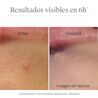 Clear & Defend+ Parches para Imperfecciones Piel Sensible