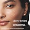 Young woman's skin after 4 weeks using Neutrogena Hydro Boost Gel Cream for extra dry skin