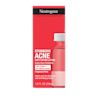 NTG_070501103227_US_STUBBORN_ACNE_DRYING_LOTION_1OZ_00000.webp