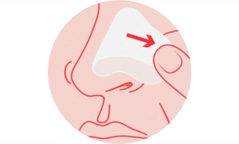 Remove patch. To remove, carefully loosen one end of the patch by stretching it along the skin slowly. Do not pull upward.