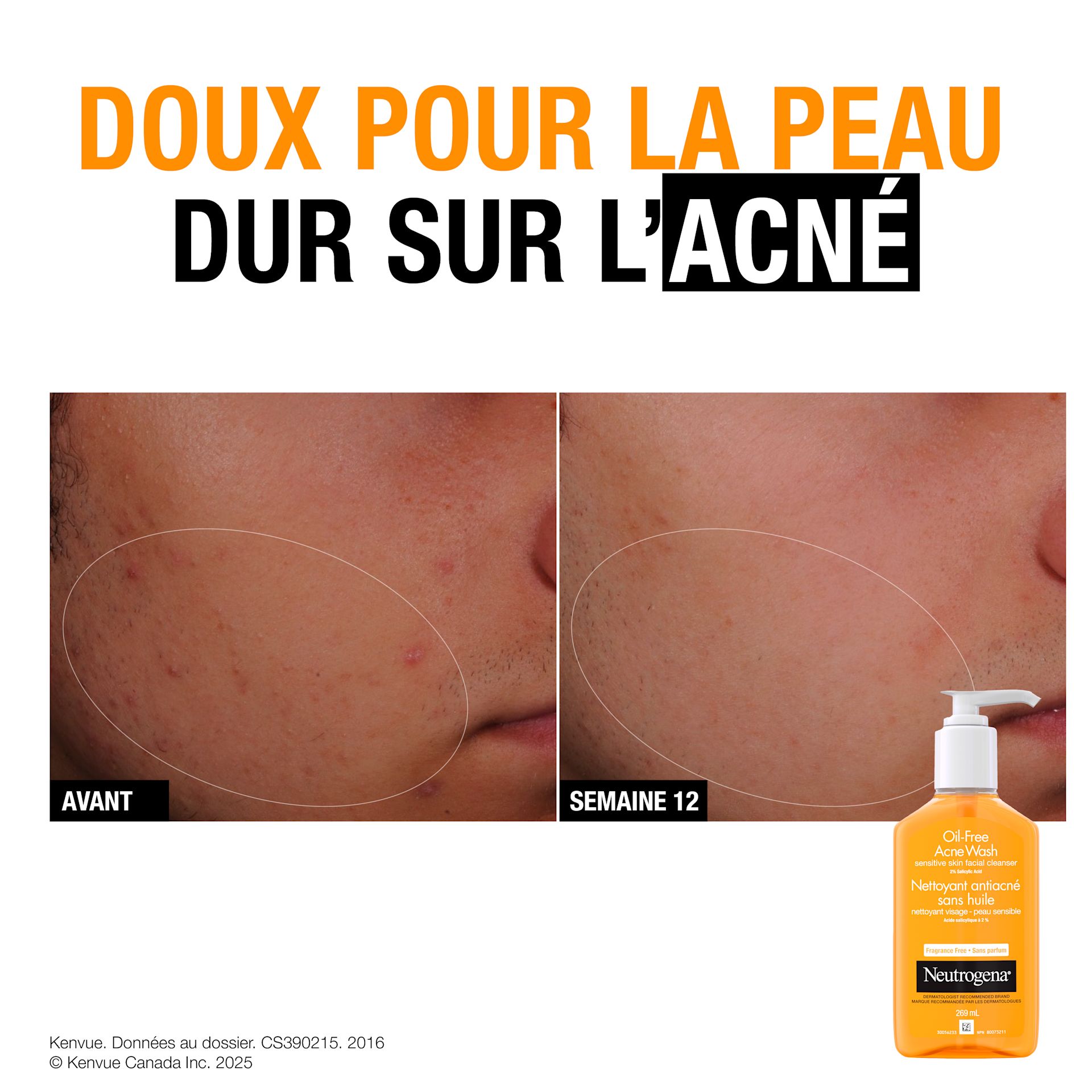 NTG NA CA 62600651464 100065146 OFAW 269ML B&A FR (1)