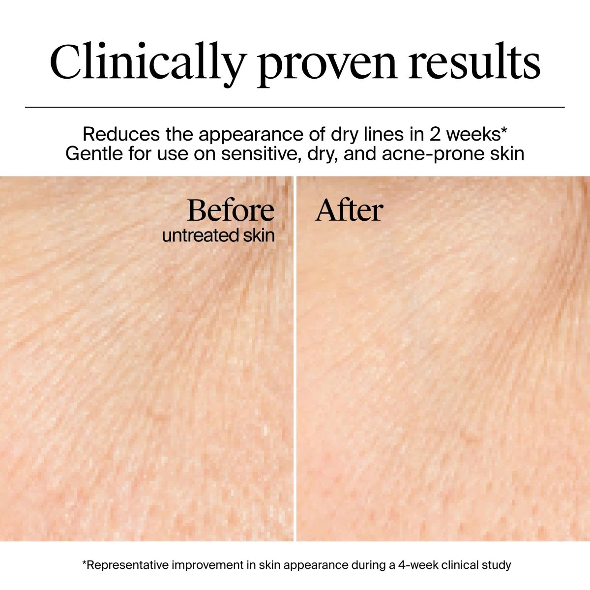 122402_KEN_US_NTG_Face_HYDROBOOST_Gel_Cream_ATF_05.webp