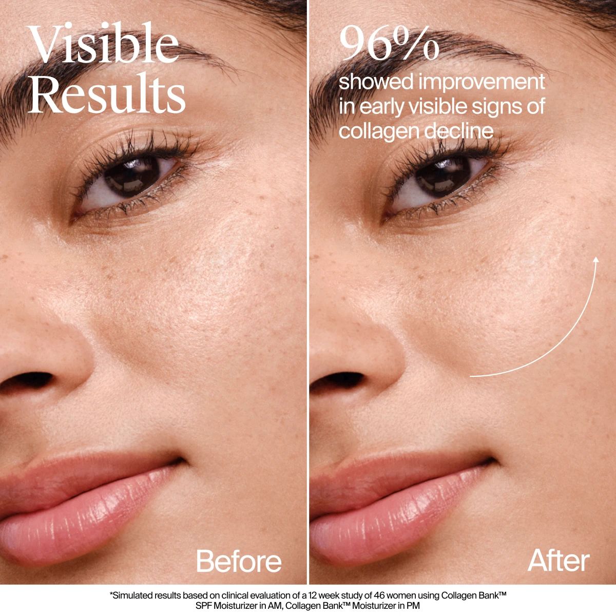 Before/after: 96% showed improvement in early visible signs of collagen decline