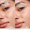 Before/after: 96% showed improvement in early visible signs of collagen decline