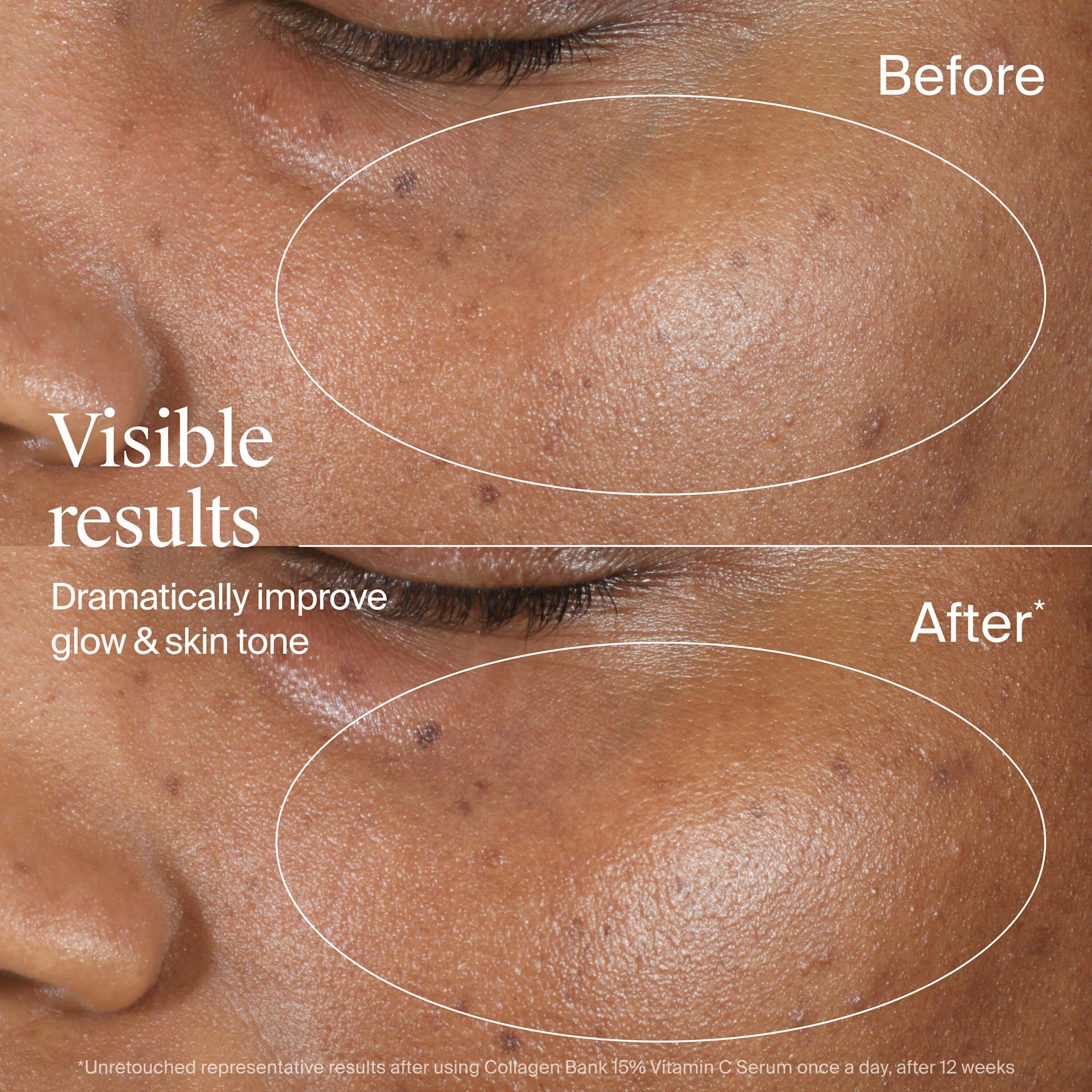 NTG EMEA UK 3574661889511 908809 Neutrogena Collagen Bank 15- VitaminC Serum 15ml SI06 THUMB JPG