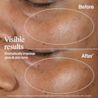 NTG EMEA UK 3574661889511 908809 Neutrogena Collagen Bank 15- VitaminC Serum 15ml SI06 THUMB JPG