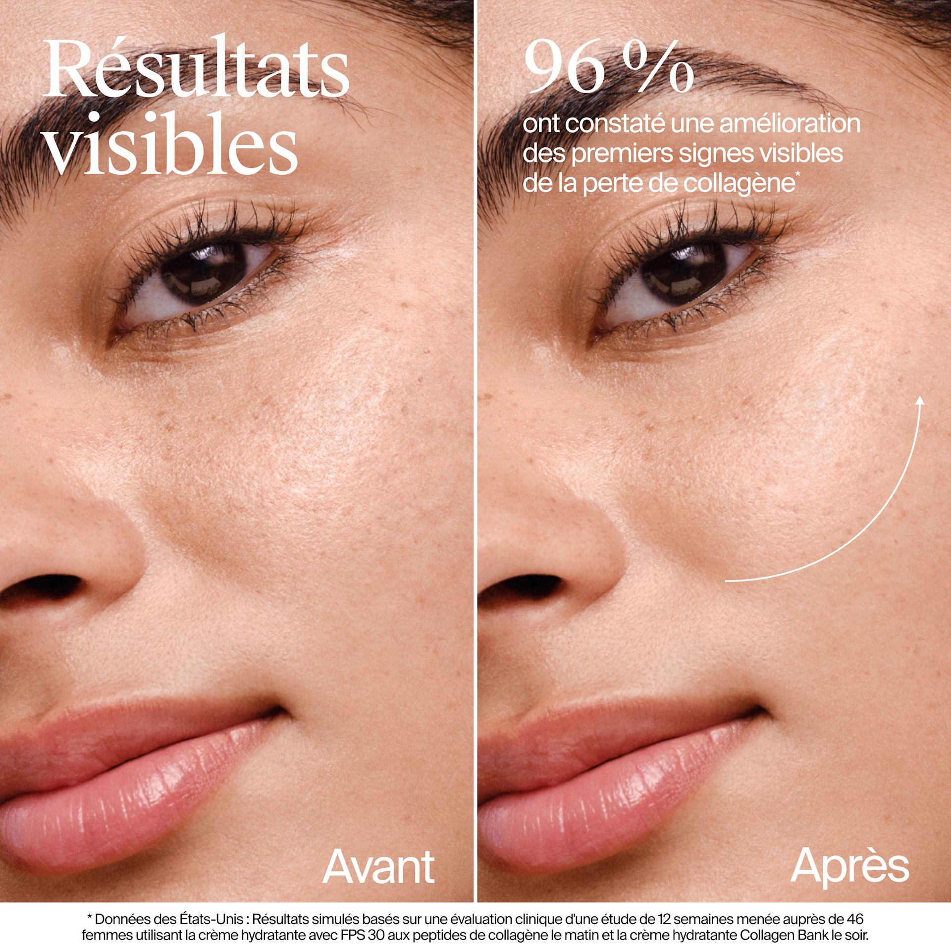 NA US NTG CollagenBank Moisturizer 2floz BeforeAndAfter ATF4 Amazon 3000x3000 NA US NTG CollagenBank Moisturizer 2floz BeforeAndAfter ATF4 Amazon 3000x3000