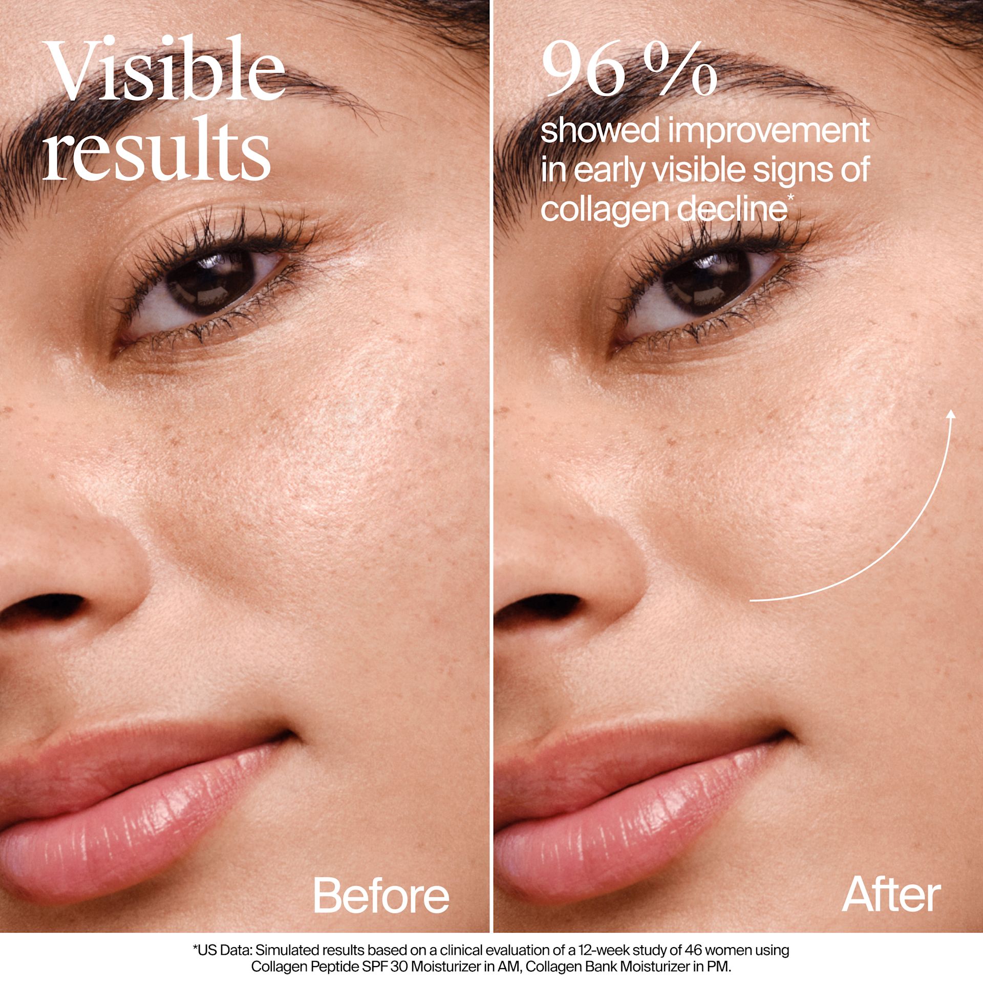 NA US NTG CollagenBank Moisturizer 2floz BeforeAndAfter ATF4 Amazon 3000x3000