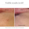 NTG EMEA UK 3574661889047 91005800 EMEA Neutrogena Sensitive Blemish Patch 30pc SI09 THUMB JPG