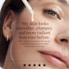 Rapid Wrinkle Repair Retinol Renewal Serum testimony: “My skin looks smoother, plumper, and more radiant than ever before“
