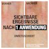 Neutrogena® Norwegische Formel Intense Repair sichtbare Ergebnisse nach 1 Anwendung