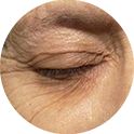 Before using NEUTROGENA® Retinol SA for wrinkles & crows feet