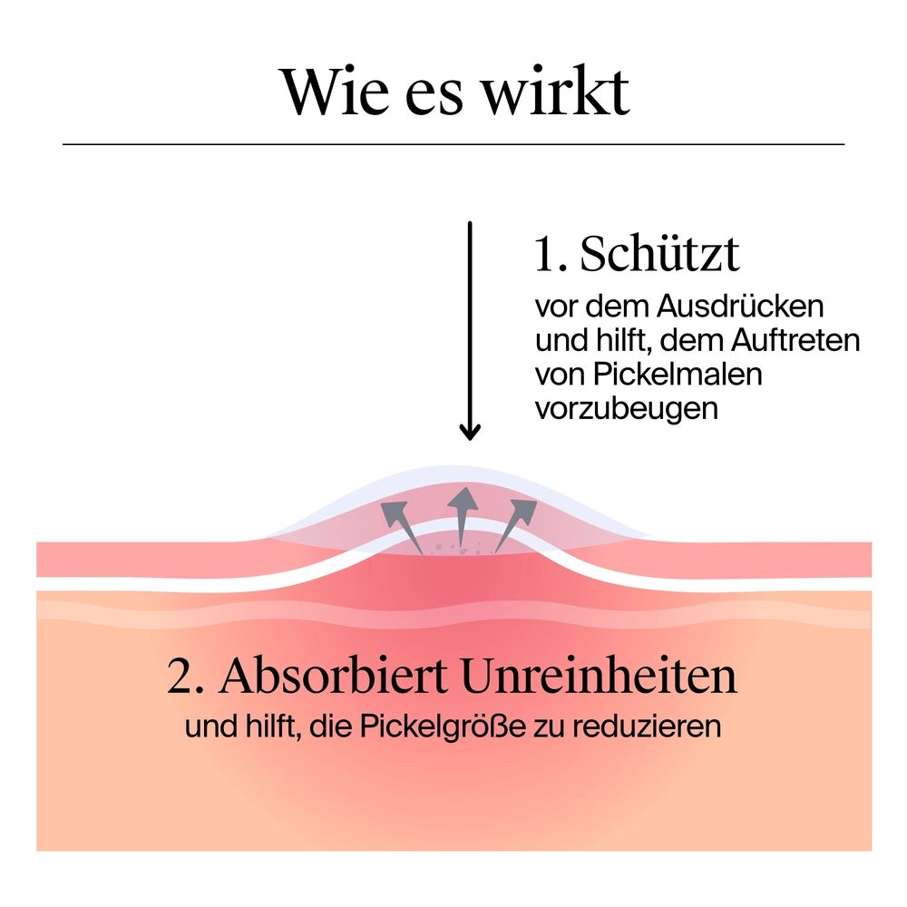 Neutrogena® Anti-Pickel+ Ultra-Dünne Pickel Patches Wie es wirkt, schützt und Unreinheiten absorbiert