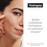 NTG EMEA FR 3574661916156 SEN SKIN BLEM PATCH 30P SI01 THUMB JPG