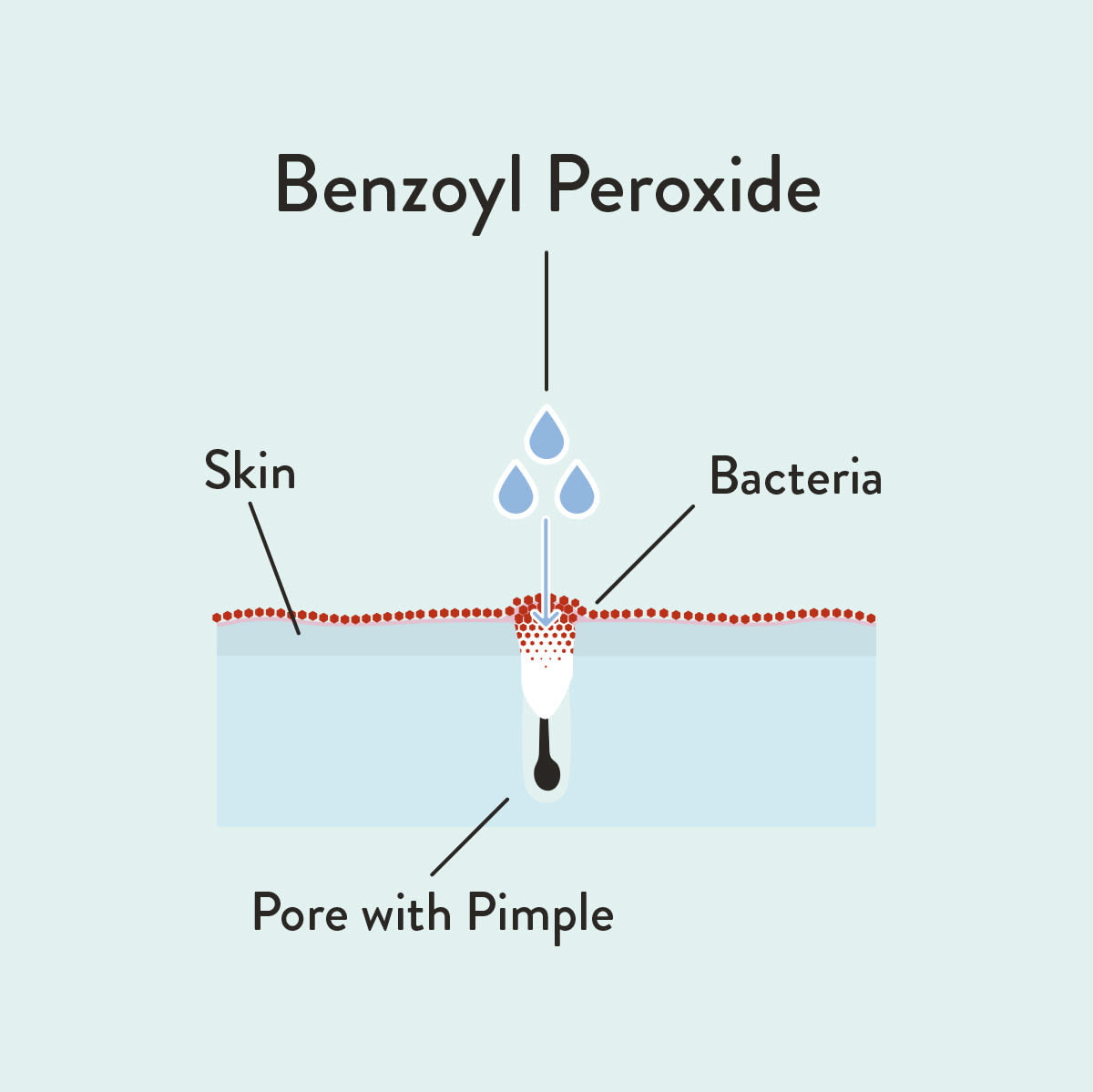 Benzoyl Peroxide
