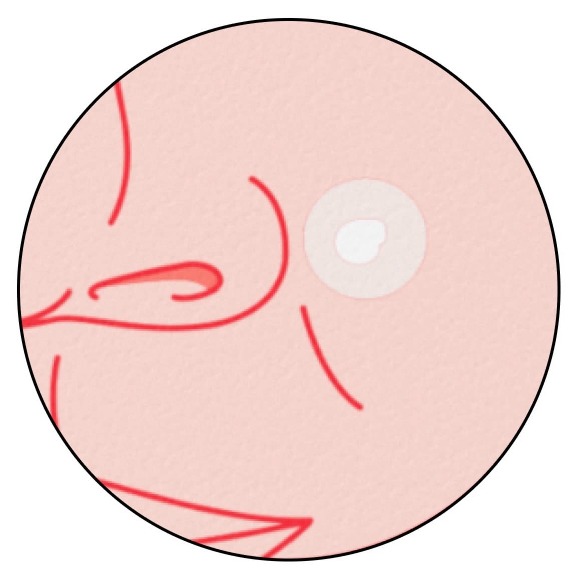 NA-US-NTG-Acne-MiniAcnePatch-Application-BTF2-Amazon-1464x600