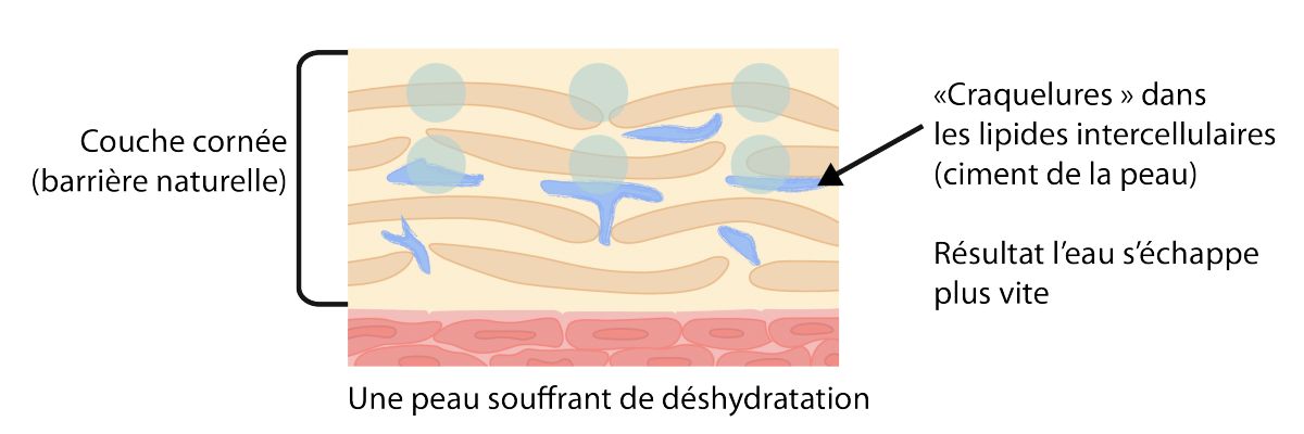 L’importance d’une barrière cutanée protégée | Peau deshydratee