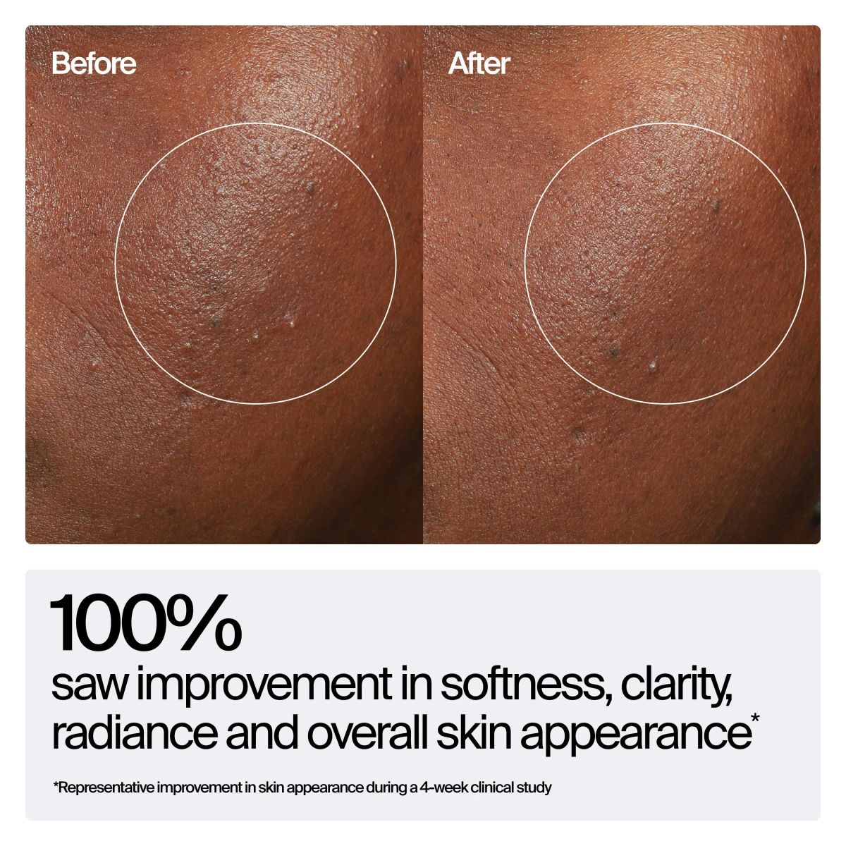 123821_KEN_US_NTG_NPI_HB_Rejuvenating_Serum_ATF_05.webp