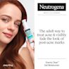 NA-US-NTG-Acne-GelMoisturizer-KV-ATF2-Amazon-3000x3000.webp