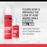 Neutrogena® Stubborn Texture™ cleanser and Stubborn Marks™ treatment for clearing acne and marks
