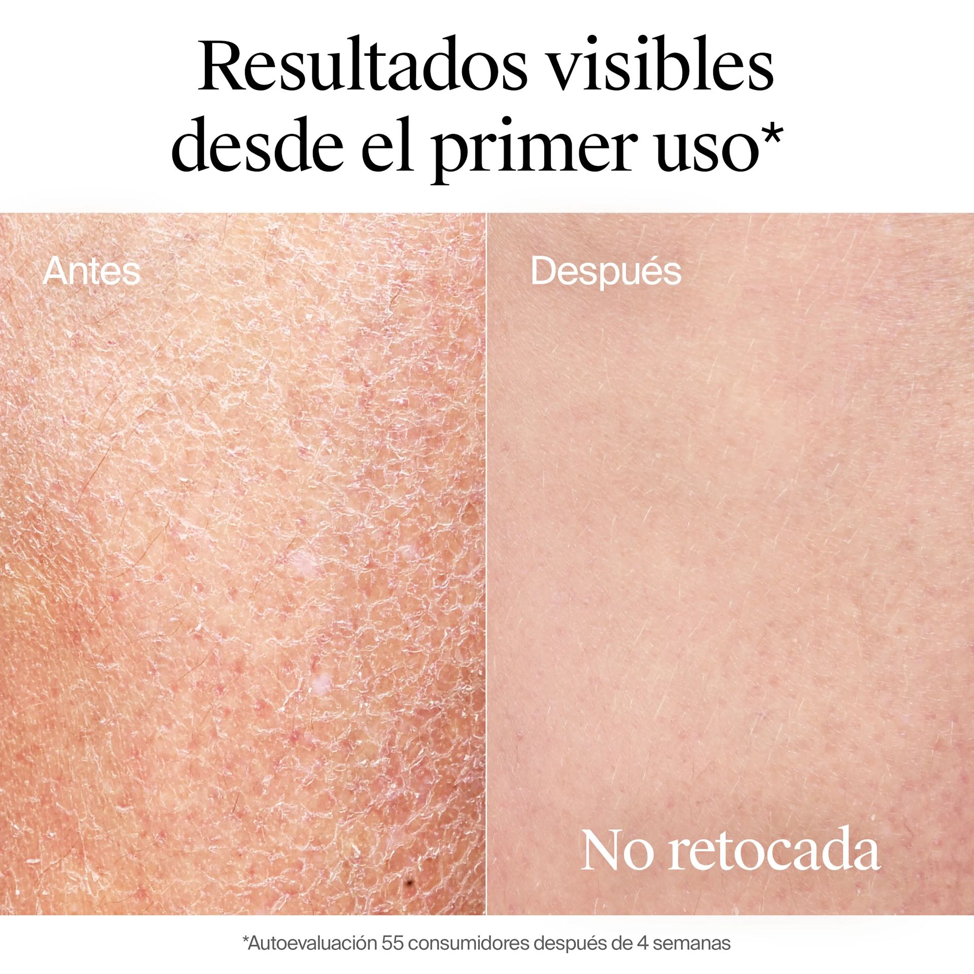 Neutrogena® Hidratación Profunda Loción Hipoalergénica - Image 5 - Neutrogena - es-ES