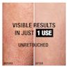 RW DS6 Neutrogena SkinVitals Ecomm Deep Moisture Sensitive Thumbnail 3 JPG