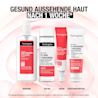 Gesund aussehende Haut nach einer Woche mit der Neutrogena Anti-Pickel Routine aus Reinigung, Peeling, Serum und Feuchtigkeitspflege. Dermatologische Beurteilung, 34 Anwender:innen, Anwendung des Daily Serum einmal täglich über einen Zeitraum von einer Wo