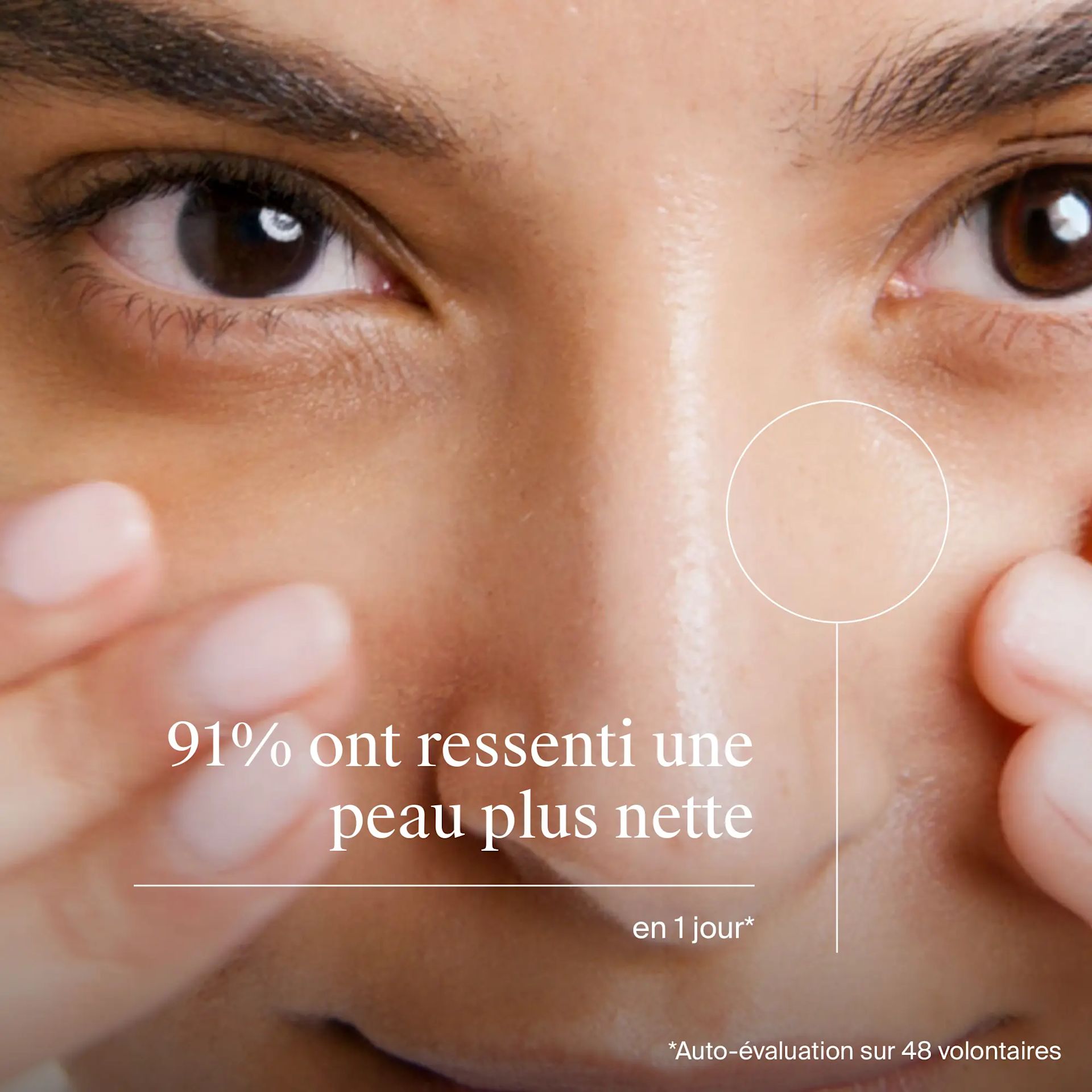 Anti-points noirs : lotion désincrustante