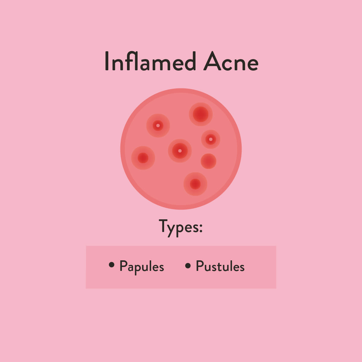 Inflamed Acne