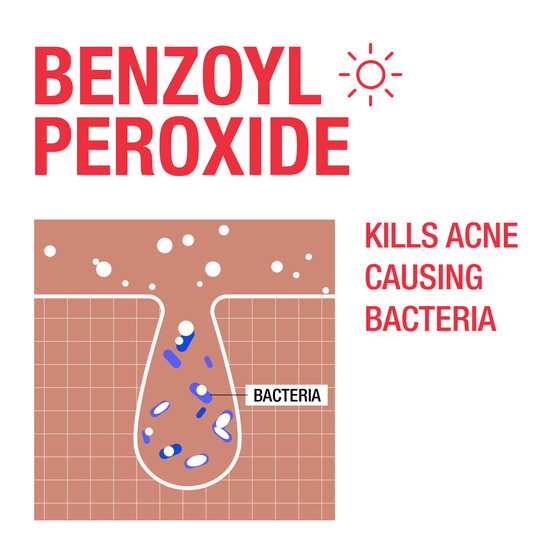 Image montrant comment le peroxyde de benzoyle tue les bactéries responsables de l'acné
