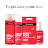 NTG_Stubborn Acne Body Cleanser_00070501064283_006.webp NTG_Stubborn Acne Body Cleanser_00070501064283_006.webp