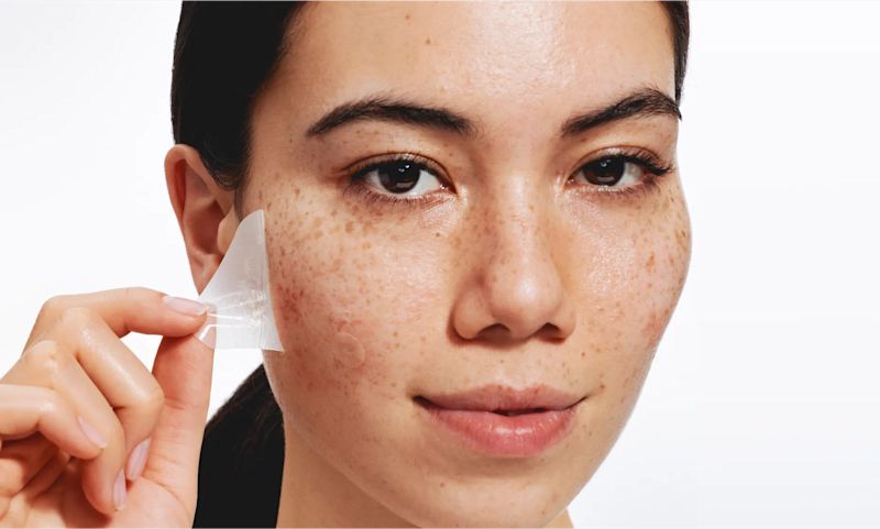 A person with freckles on their face smiles while a hand peels a large, clear acne patch off their cheek.