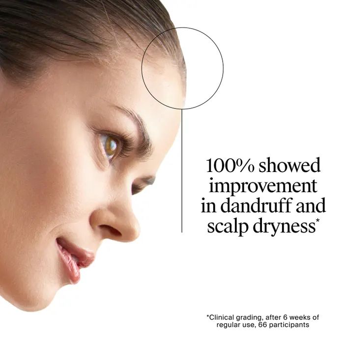 v4 Scalp Relief 4