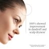 v4 Scalp Relief 4