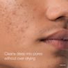 Cleans deep into pores without over-drying for clearer, healthier-looking skin
